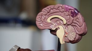 Plastic representation of a brain.